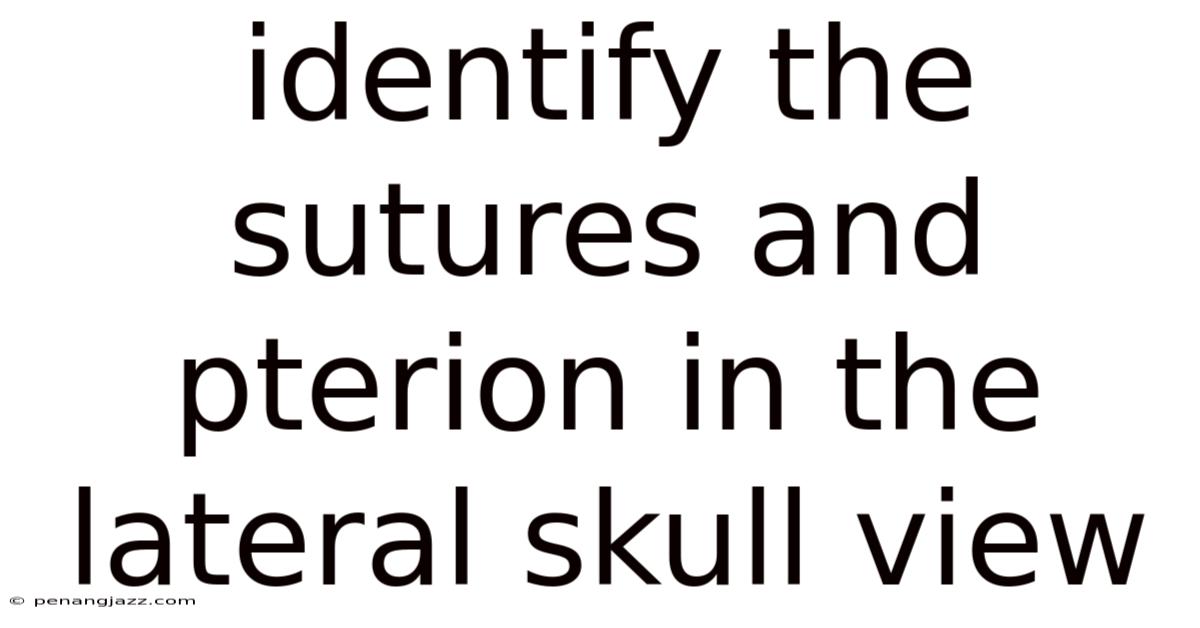 Identify The Sutures And Pterion In The Lateral Skull View
