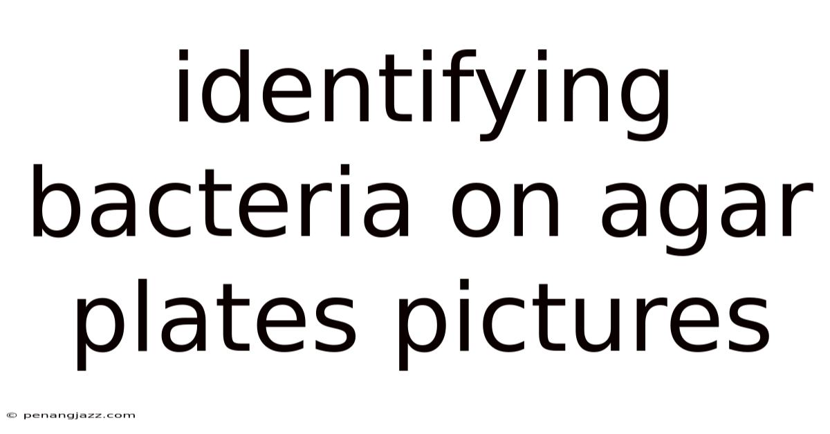 Identifying Bacteria On Agar Plates Pictures