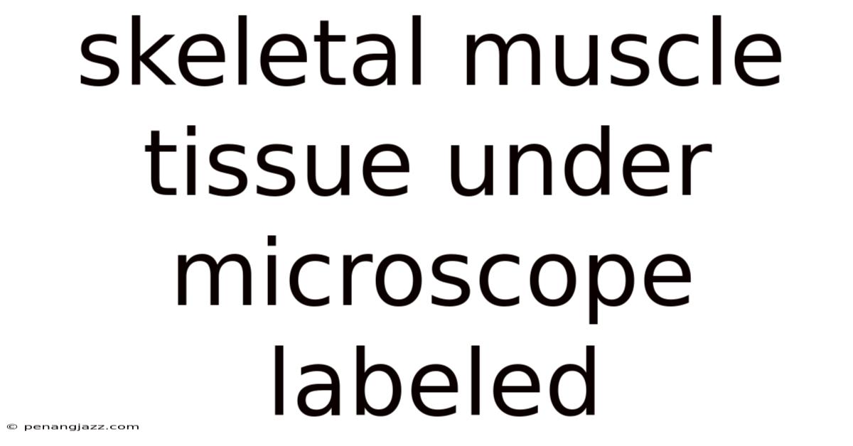 Skeletal Muscle Tissue Under Microscope Labeled